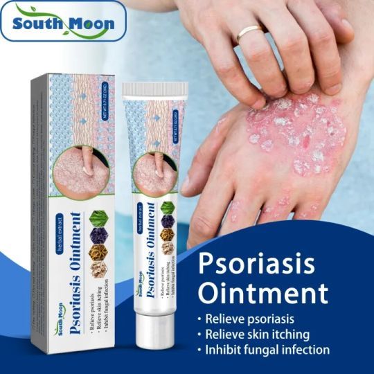South Moon Psoriasis Ointment